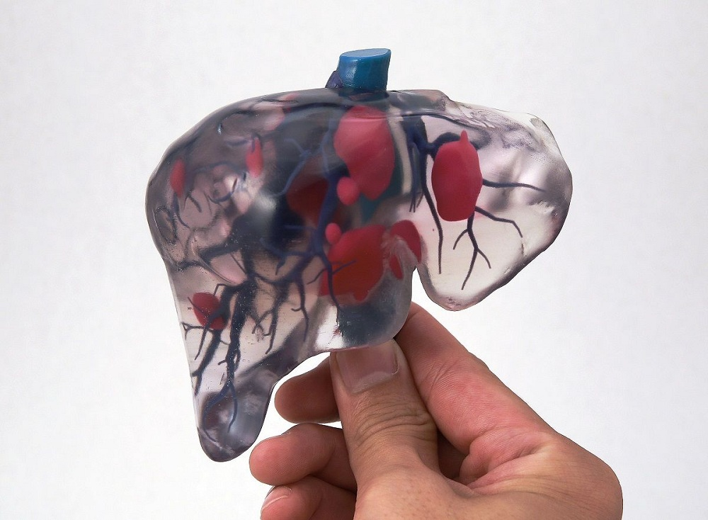 Ưu điểm và quy trình của in 3D sinh học nội tạng để cấy ghép