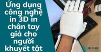 Ứng dụng công nghệ in 3D in chân tay giả cho người khuyết tật