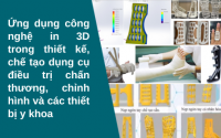 Ứng dụng công nghệ in 3D trong thiết kế, chế tạo dụng cụ điều trị chấn thương, chỉnh hình và các thiết bị y khoa